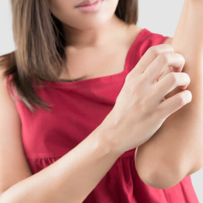 Managing dermatitis – 11 remedies for itchy skin