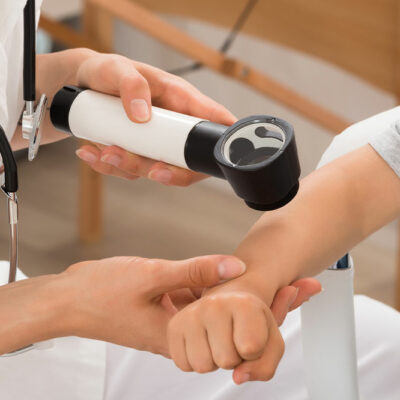 Eczema – Causes, Symptoms, Management, and More