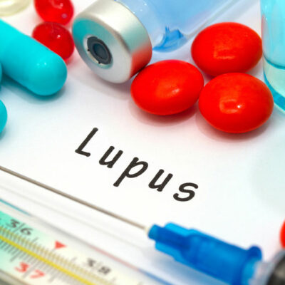 Lupus – Types and Warning Signs