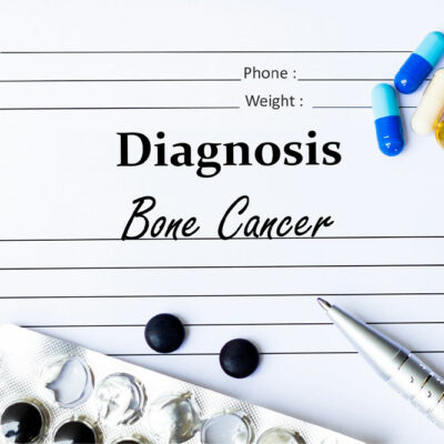 Bone cancer – Types, warning signs, lifestyle tips, and more